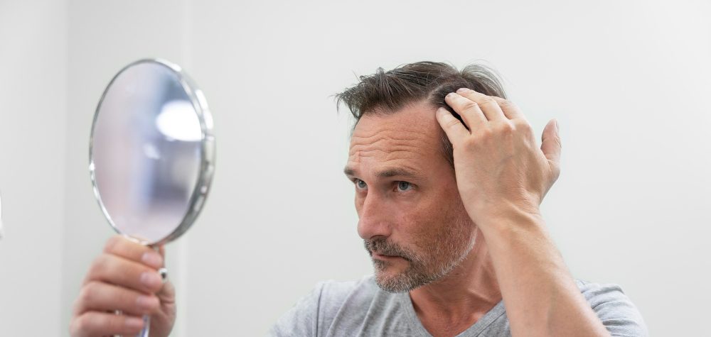 doen&ccedil;as que causam queda de cabelo